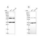 Anti-DNAJC17 Antibody
