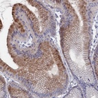 Anti-NUTF2 Antibody