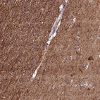 Anti-NAA60 Antibody