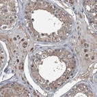 Immunohistochemical staining of human testis shows moderate cytoplasmic positivity in Leydig cells.