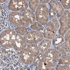 Anti-NAA60 Antibody
