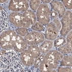 Immunohistochemical staining of human kidney shows moderate cytoplasmic positivity in cells in tubules.