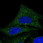 Immunofluorescent staining of human cell line U-2 OS shows positivity in cytoplasm.