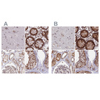 Anti-POLR2C Antibody
