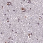 Immunohistochemical staining of human cerebral cortex using Anti-POLR2C antibody HPA040919.
