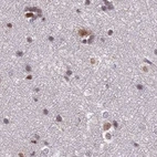 Immunohistochemical staining of human cerebral cortex using Anti-POLR2C antibody HPA040919.