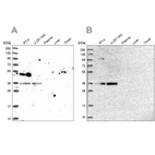 Western blot analysis using Anti-POLR2C antibody HPA040919 (A) shows similar pattern to independent antibody HPA041826 (B).