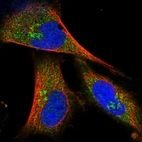 Immunofluorescent staining of human cell line U-251 MG shows localization to the Golgi apparatus.