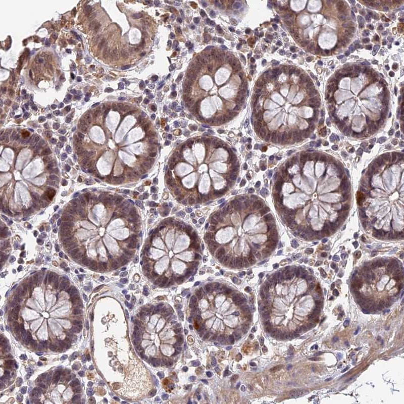Anti-FAM98C Antibody