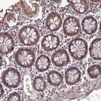 Anti-FAM98C Antibody