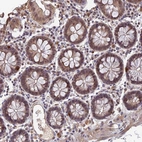 Anti-FAM98C Antibody