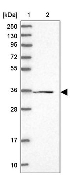 Lane 1: Marker [kDa] 250, 130, 95, 72, 55, 36, 28, 17, 10_br/_Lane 2: Human cell line RT-4