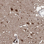 Anti-C18orf32 Antibody