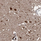 Anti-C18orf32 Antibody