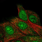 Immunofluorescent staining of human cell line MCF7 shows localization to nucleus, nucleoli & cytosol.