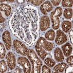 Immunohistochemical staining of human kidney shows strong cytoplasmic positivity in cells in tubules.
