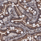 Immunohistochemical staining of human duodenum shows strong cytoplasmic positivity in glandular cells.