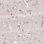 Immunohistochemical staining of human Cerebral cortex shows strong granular cytoplasmic positivity in neurons.