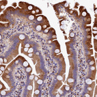 Immunohistochemical staining of human Small intestine shows moderate granular cytoplasmic positivity in glandular cells.