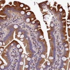 Immunohistochemical staining of human Small intestine shows moderate granular cytoplasmic positivity in glandular cells.