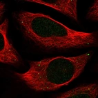 Immunofluorescent staining of human cell line U-2 OS shows localization to vesicles.