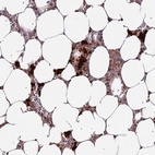 Immunohistochemical staining of human bone marrow shows high expression.