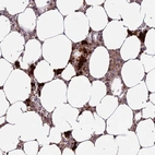 Immunohistochemical staining of human bone marrow shows high expression.