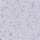Immunohistochemical staining of human cerebral cortex shows low expression as expected.