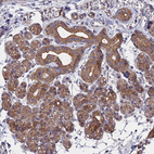 Anti-ZCCHC2 Antibody