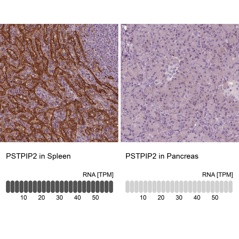 Anti-PSTPIP2 Antibody