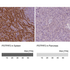 Anti-PSTPIP2 Antibody