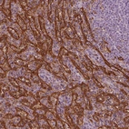 Immunohistochemical staining of human spleen shows strong cytoplasmic positivity in cells in red pulp.