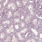 Immunohistochemical staining of human kidney shows no positivity in cells in tubules as expected.
