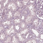 Immunohistochemical staining of human kidney shows no positivity in cells in tubules as expected.