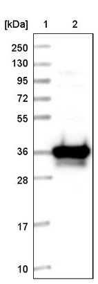 Lane 1: Marker [kDa] 250, 130, 95, 72, 55, 36, 28, 17, 10_br/_Lane 2: Human cell line RT-4