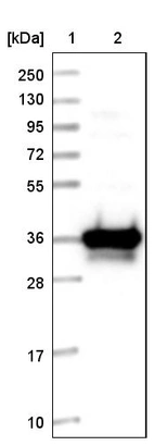 Lane 1: Marker [kDa] 250, 130, 95, 72, 55, 36, 28, 17, 10_br/_Lane 2: Human cell line RT-4