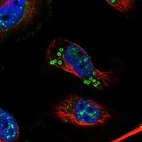 Immunofluorescent staining of human cell line U-251 MG shows localization to nuclear speckles & lipid droplets.