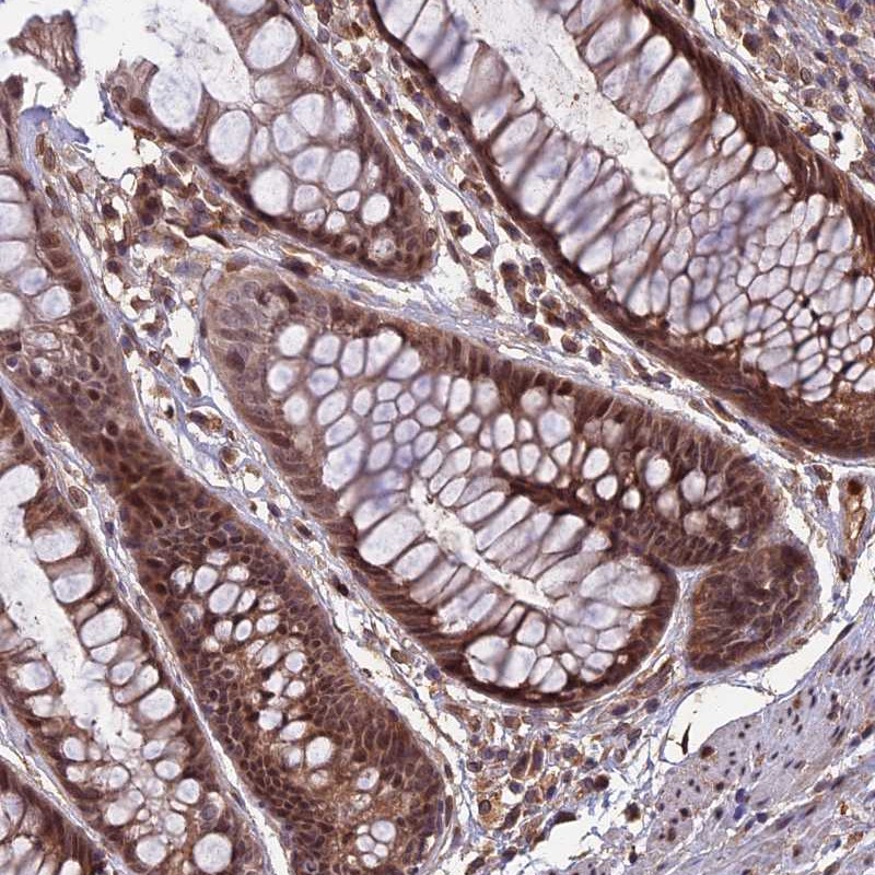 Anti-SPG11 Antibody