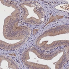 Immunohistochemical staining of human gallbladder shows moderate cytoplasmic positivity in glandular cells.