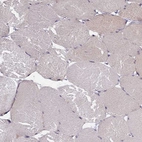 Immunohistochemical staining of human skeletal muscle shows moderate positivity in myocytes.