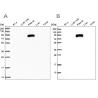 Western blot analysis using Anti-IGFALS antibody HPA040948 (A) shows similar pattern to independent antibody HPA040692 (B).
