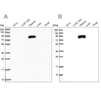Western blot analysis using Anti-IGFALS antibody HPA040948 (A) shows similar pattern to independent antibody HPA040692 (B).