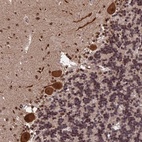 Anti-OSBPL1A Antibody