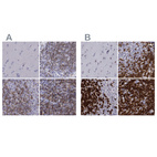 Immunohistochemical staining of human cerebral cortex, lymph node, spleen and tonsil using Anti-CD3E antibody HPA040957 (A) shows similar protein distribution across tissues to independent antibody HPA043955 (B).