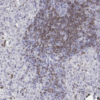 Immunohistochemical staining of human purkinje layer of the cerebellum shows no cytoplasmic positivity as expected.