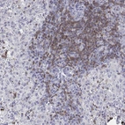 Immunohistochemical staining of human purkinje layer of the cerebellum shows no cytoplasmic positivity as expected.
