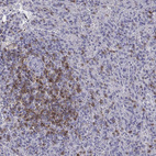Immunohistochemical staining of human spleen shows weak to moderate cytoplasmic positivity in cells in red pulp.