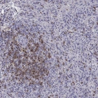 Immunohistochemical staining of human spleen shows weak to moderate cytoplasmic positivity in cells in red pulp.