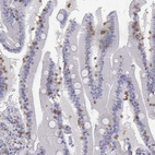 Immunohistochemical staining of human small intestine shows weak to moderate cytoplasmic positivity in lymphoid cells.