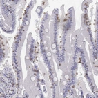 Immunohistochemical staining of human small intestine shows weak to moderate cytoplasmic positivity in lymphoid cells.